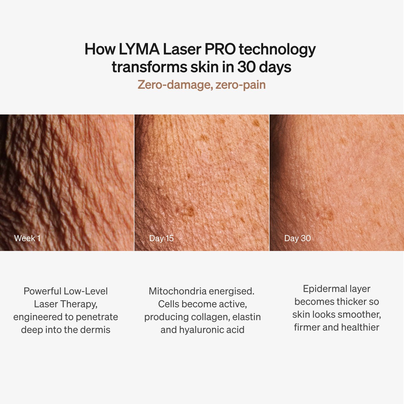 LYMA | Laser PRO - Helvetskin